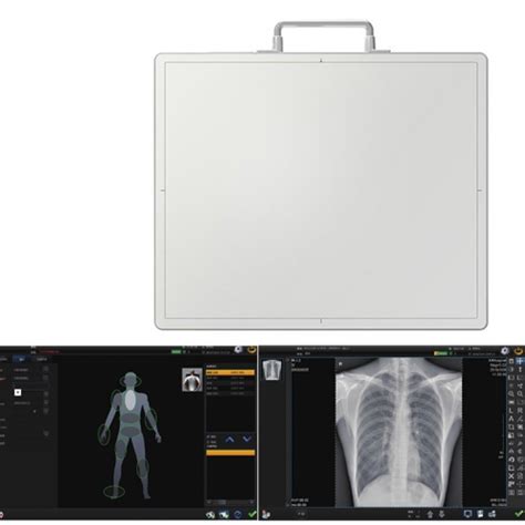 X Ray Machine Flat Panel Detector Yueshen Medical Equipment