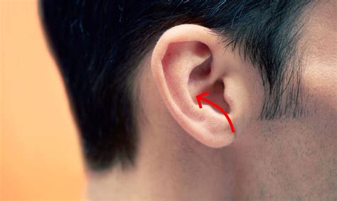A Man Had Part Of His Ear Cut Out In A Controversial “conch Removal