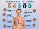 The Flu - Symptoms and Causes. | stomach flu symptoms