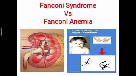 Fanconi Syndrome Bruin Blog