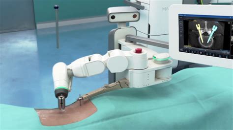 Robotic Spine Surgery With Mazor X Youtube