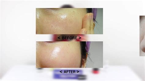 Instant And Permanent Skin Whitening Solution Youtube
