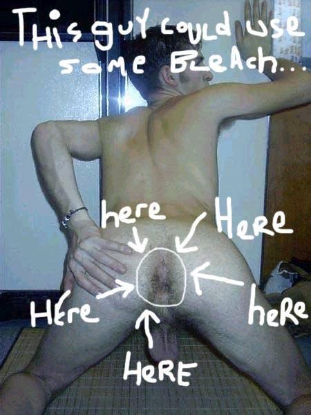 Anal Bleaching Page