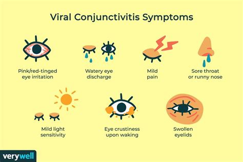 Viral Conjunctivitis Overview And More