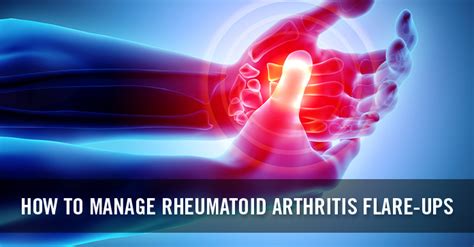 How To Manage Rheumatoid Arthritis Flare Ups Cureup