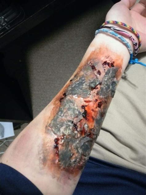 3rd Degree Burn Special Effects Makeup Amino