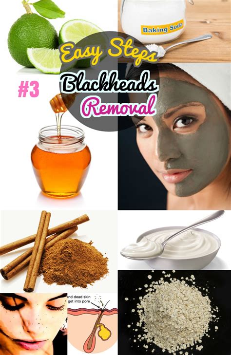 Diy Easy Blackhead Removal 3 How To Get Rid Of Blackheads Fast