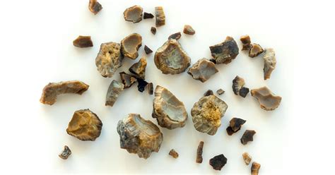 Cystine Stones In Dogs