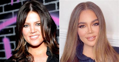 Did Khloe Kardashian Get Plastic Surgery Experts Weigh In On Her