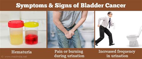 Bladder Cancer Symptoms Signs Diagnosis Treatment Prognosis