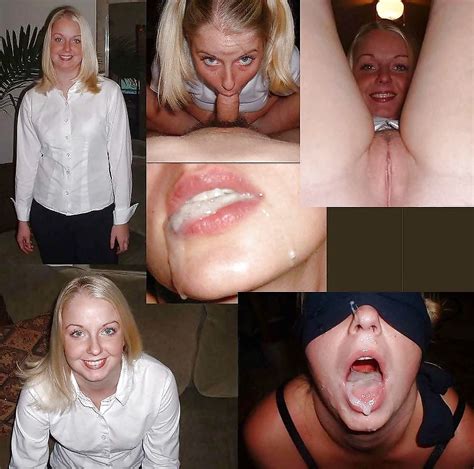 Amateur Before And After Facial Collection 2 23 Pics Xhamster