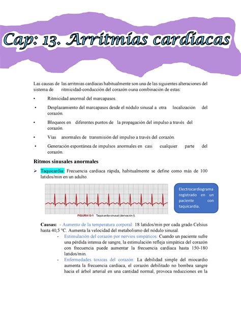 Arritmias Cardiacas Lecture Notes Cardio Las Causas De Las