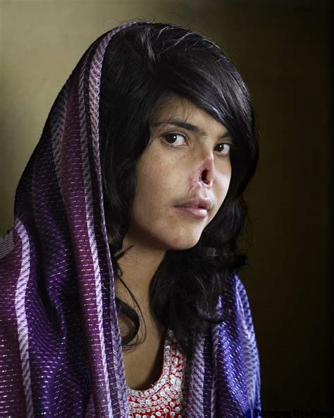 Image Of Afghan Woman Whose Nose Was Cut Off By Taliban Wins 1st Prize