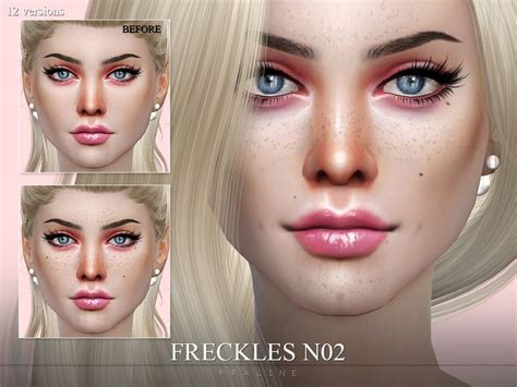 Freckles And Beauty Spots In 12 Versions Found In Tsr