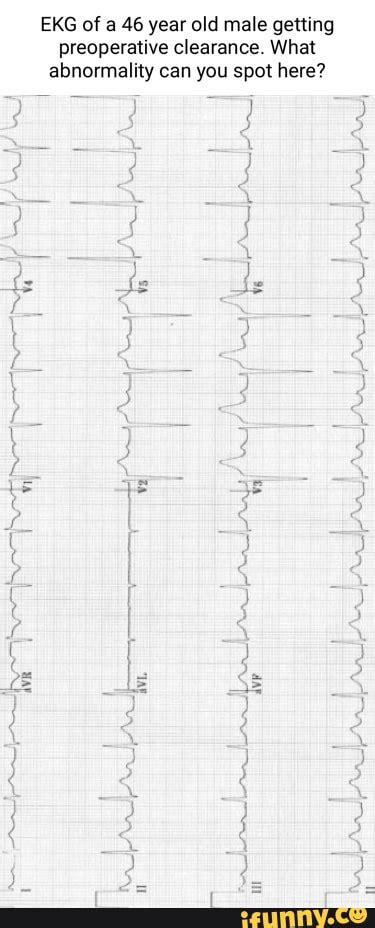 Ekg Memes Best Collection Of Funny Ekg Pictures On Ifunny