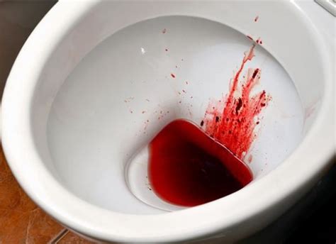 Blood in the urine is a key sign of bladder cancer. 10 Indications Of Kidney Improper Functioning - Girlicious ...