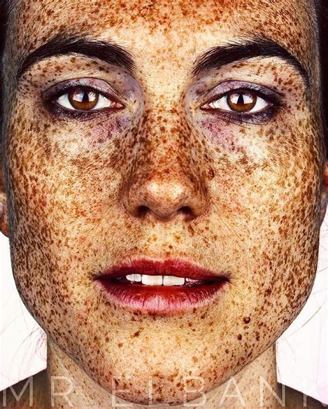 Stunning Portraits Celebrate The Unique Beauty Of Freckled Faces — My