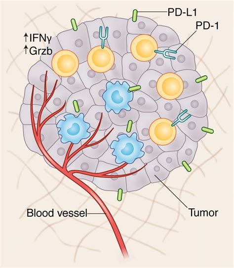 Pursuit Of Tumor Infiltrating Lymphocyte Immunotherapy Speeds Up