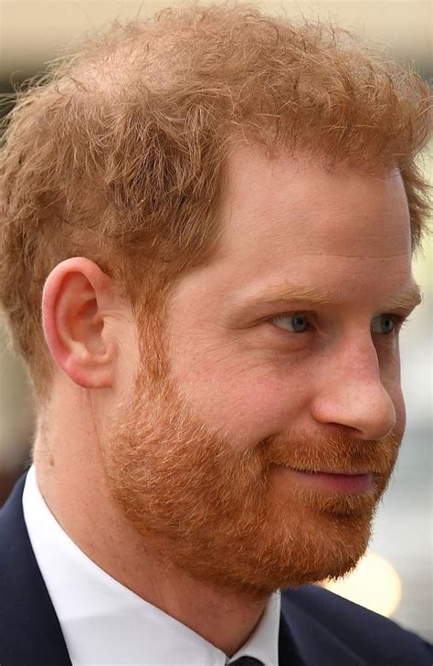 Royal Hair Prince Harry Seeks Help From Clinic As He Starts To Go Bald