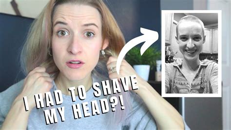 A Doctor Made Me Shave My Head For No Reason Storytime