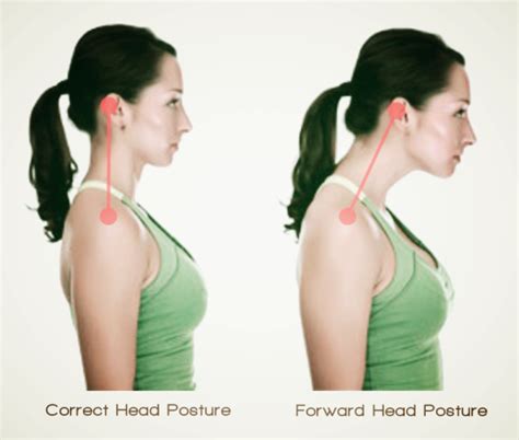 What Are Some Ways To Improve Your Posture Neck Pain Support Blog