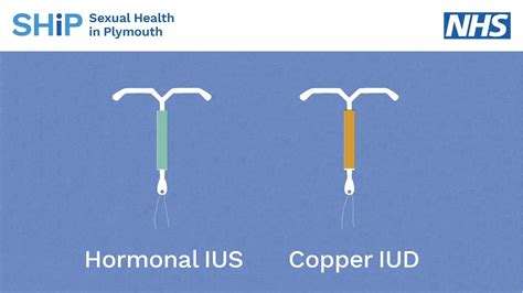 Your doctor or nurse practitioner will write you a script and you can get the iud from a pharmacy. Having an IUD/IUS contraception fitted - YouTube