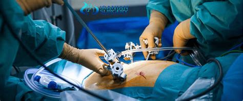 Laparoscopy Cost Laparoscopy Scars Laparoscopy Recovery Time