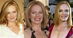 Marg Helgenberger Plastic Surgery Before and After Pictures 2020