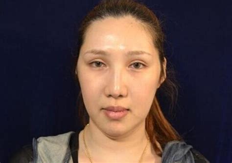 黄海波事件女主角整形照曝光 美容医院被指侵权 时尚 腾讯网