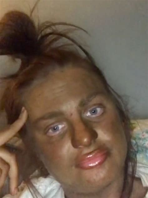 Tiktok Jodie Morris And Her St Moritz Fake Tan Fail Au