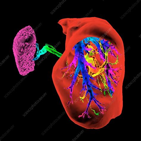Liver And Spleen And Blood Vessels 3d Ct Scan Stock Image C036