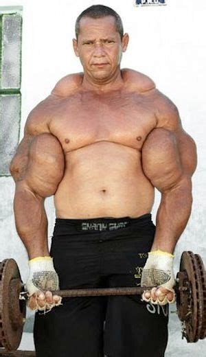 steroids gone wrong biceps