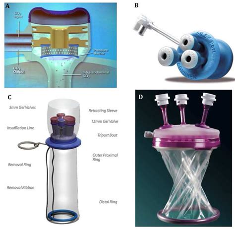 Laparoendoscopic Single Site Surgery In Gynecology Review Of