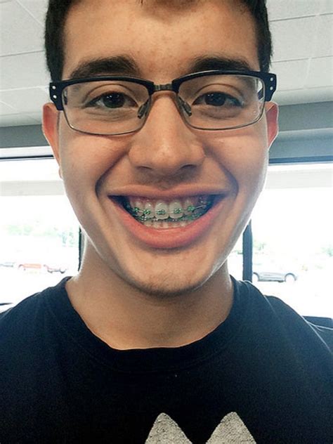 Glasses And Braces The Perfect Combination Perfect Teeth Metal Braces Teeth