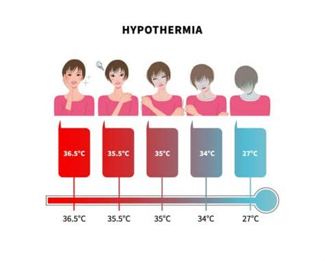 Hypothermia Signs Symptoms And Effective Treatment