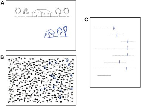 These include cancellation tests (eg, see figure 3), line bisection as well as. Performance of a patient with left spatial neglect on ...