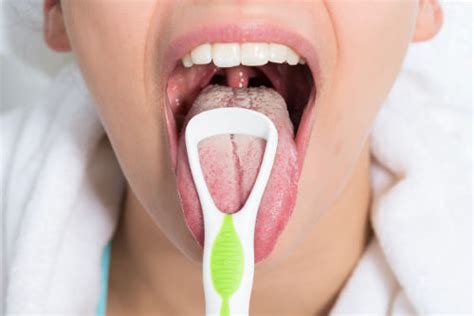Bumps On Back Of Tongue Causes And Natural Treatments