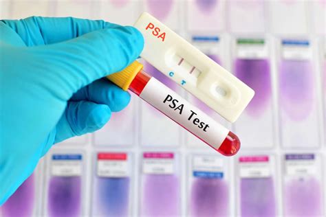Psa Test Results Elevated Psa Levels And Normal Psa Levels By Age