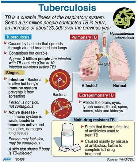 Infographic On Tuberculosis Test Kit
