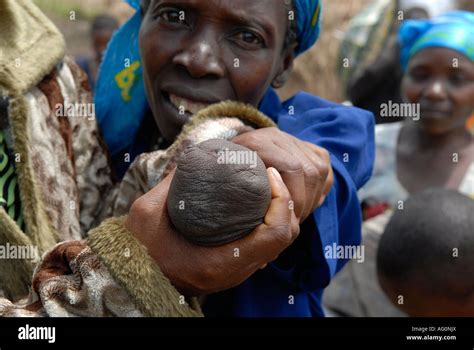 An Internally Displaced Woman Shows Her Arm Cut Off By Rebel Militia