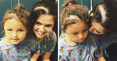Mom Shaves Her Head So Her Daughter Wouldnt Feel Different After Brain Surgery Bored Panda