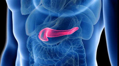 Type 3c Diabetes Could Be An Early Manifestation Of Pancreatic Cancer