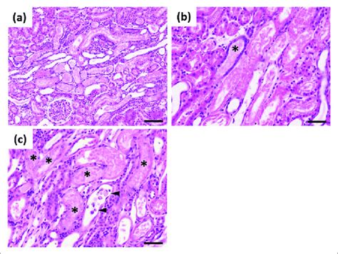 Histopathological Changes In The Kidneys A Acute Tubular Necrosis