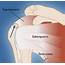 Rotator Cuff Repair  Welcome To Alosh Orthopedics