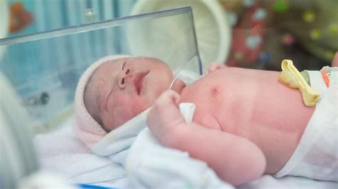 Steroids Protect Preemies Brains Stanford Study Finds