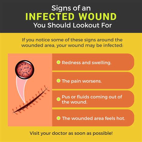 Wounds As Related To Surgery Pictures