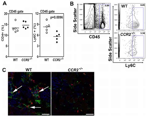 Ly6c Monocyte Recruitment Is Required For Glomerular Inflammation B6