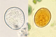 Entamoeba coli parasite | Medical Laboratories