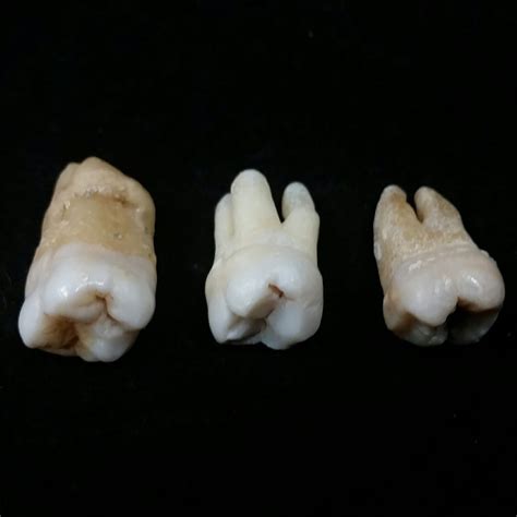 Human Teeth Molars Skullstore Inc