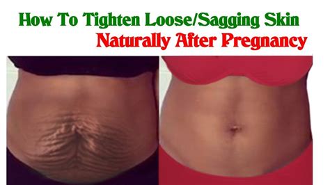 How I Tighten Loosesagging Belly Skin After Pregnancythis Is Fastest